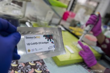 Pemerintah berencana gunakan tes cepat antigen untuk deteksi COVID-19