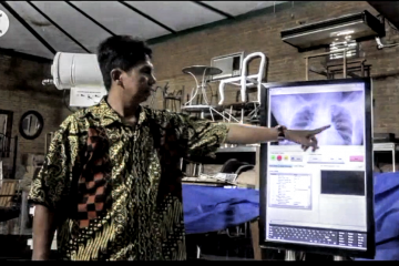 Radiografi digital dari UGM diklaim 95% akurat deteksi COVID-19