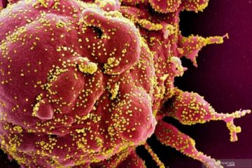 Peneliti: Belum terbukti klinis SARS-CoV2 lebih infeksius pada manusia
