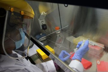 LIPI TEMUKAN ALAT DETEKSI ALTERNATIF COVID-19