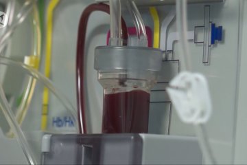 Para dokter di Argentina kumpulkan plasma darah untuk pasien COVID-19