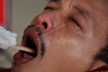 Petugas Medis Melakukan Swab
