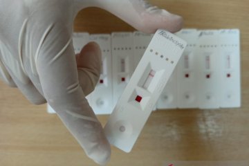 Tes cepat COVID-19 karyawan Antara