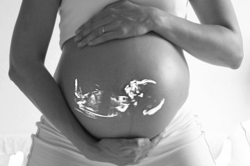 USG kehamilan harus sesuai jadwal, tapi boleh lebih dari seharusnya?