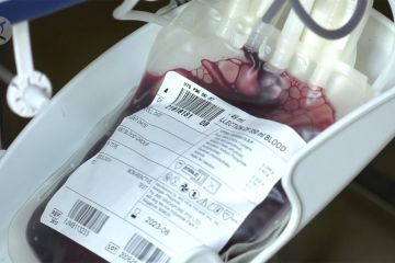 Tingkatkan pelayanan donor plasma konvalesen, PMI perlu tambah mesin Apheresis