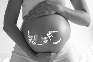 Kenali faktor risiko sebabkan kelahiran bayi prematur