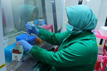PR Sukun bantu perbaikan laboratorium biomolekuler RSUD Kudus