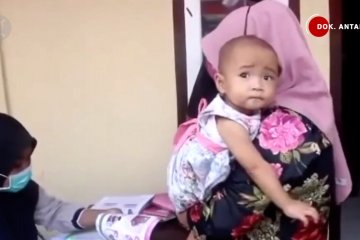 Populasi anak meningkat di tengah kasus stunting yang masih tinggi