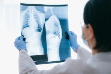 Dokter sebut cara bersihkan paru-paru secara mandiri bagi pasien PPOK