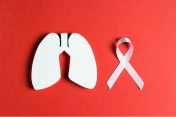 Tiga metode terapi pasien kanker paru