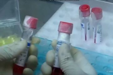 Vaksin Merah Putih segera uji klinik tahap 1