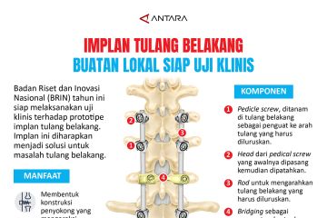 Implan tulang belakang buatan lokal siap uji klinis