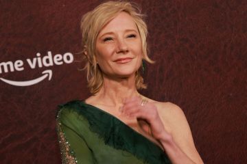 Kecelakaan mobil, aktris Hollywood Anne Heche masih koma