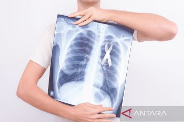 Vape juga berisiko sebabkan kanker paru