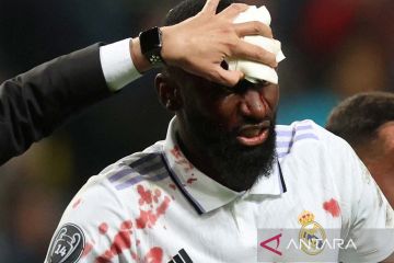 Antonio Rudiger luka parah setelah mencetak gol lawan Shakhtar Donetsk