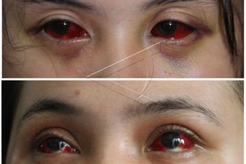 Korban Tragedi Kanjuruhan