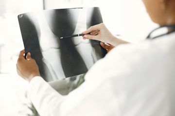 Dokter paparkan upaya cegah osteoporosis sejak dini