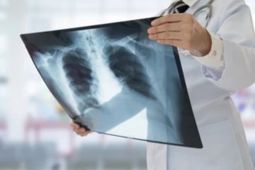 Yogyakarta optimalkan "active case finding" perkuat penanganan TB