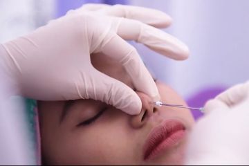 Botox dan filler jadi tren perawatan kecantikan tahun ini