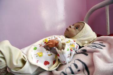 WHO: Yaman butuh bantuan internasional darurat untuk layanan kesehatan