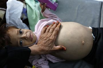 UNICEF sebut 11 juta anak Yaman butuh bantuan kemanusiaan