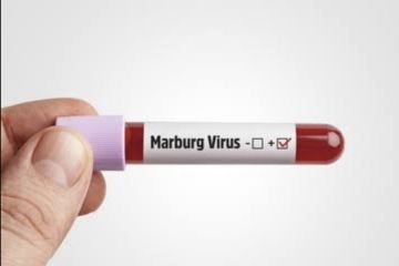 Kenali virus Marburg yang bisa bertahan pada tubuh penyintas