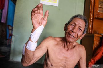 Seorang pria di Lampung Selatan terluka diserang buaya