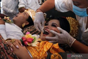 Ritual metatah atau potong gigi bagi penyandang disabilitas di Bali