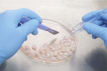 Pilih fasilitas kesehatan yang baik untuk lakukan stem cell