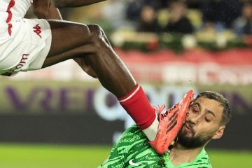 Donnarumma cedera wajah serius dalam kemenangan PSG atas Monaco  