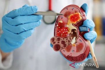 Ciri ginjal yang sakit hingga robot penyadap karet yang masuk RI