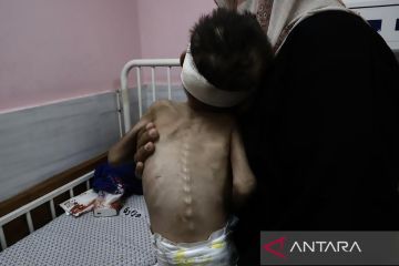 WHO: 57 anak Gaza meninggal kelaparan sejak blokade Israel