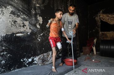 Anak Palestina korban serangan Israel harus kehilangan kaki kiri dan tangan kanannya