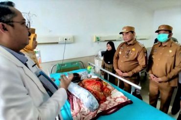 Shalahuddin minta pelayanan maksimal bagi bayi penderita hidrosefalus