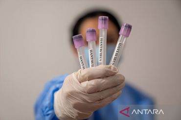 Dinkes sebut suspek hantavirus di Kulon Progo hasilnya negatif