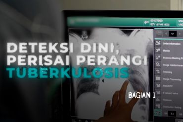 Deteksi dini, perisai perangi tuberkulosis (bagian 1)