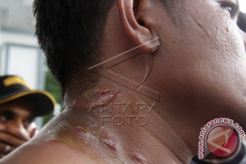 Korban Kesalahan Cambuk Lapor Polisi