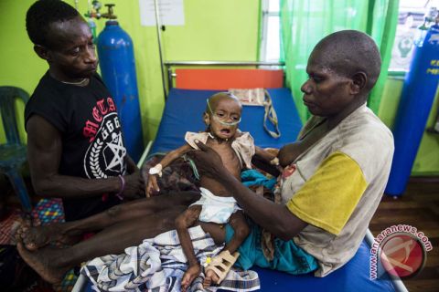 Penderita Gizi Buruk