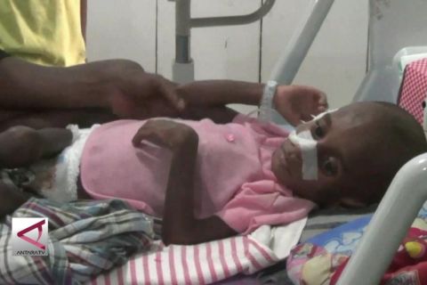 Presiden: stunting ancaman bagi kualitas SDM Indonesia