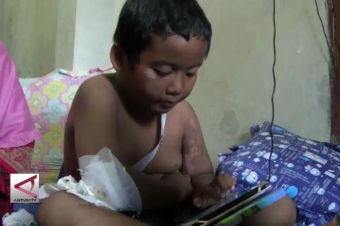 Pemerintah tanggung tunggakan biaya RS korban Tsunami