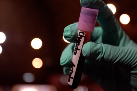 Pemprov Aceh fokus turunkan angka penderita talasemia