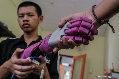 Tangan bionik buatan siswa SMK