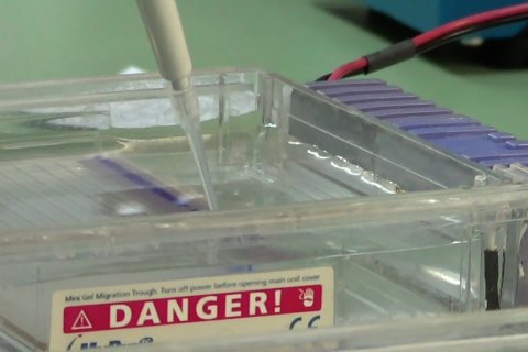 LBM Eijkman sebut perlu pemeriksaan silang untuk deteksi corona