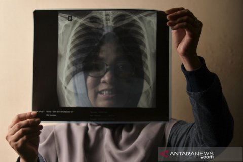 Para penakluk corona