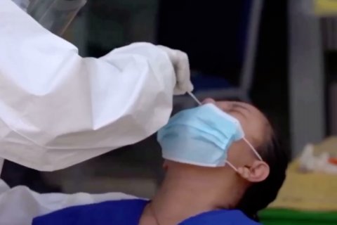 Dokter Paru : Delirium gejala umum penyakit infeksi, tidak hanya COVID-19