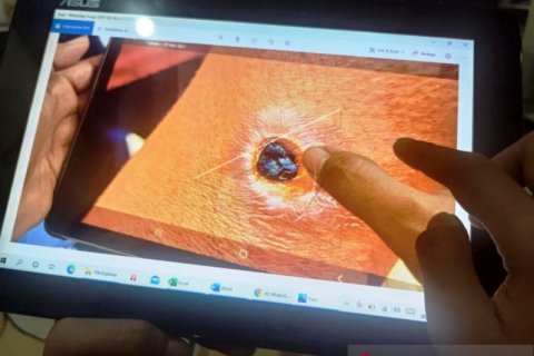 Temuan kasus Antraks Di Tulungagung