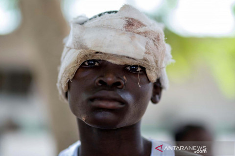 Korban gempa bumi berkekuatan 7,2 SR di Haiti