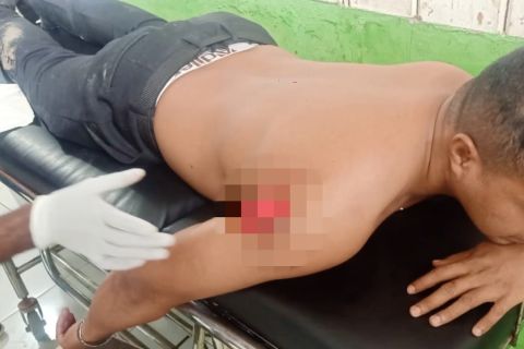 Kontak senjata dengan KKB di Pegubin, tiga polisi terluka