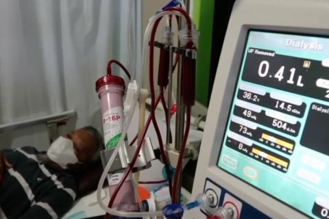 Ini jenis-jenis kanker tertinggi di Indonesia berdasarkan gender