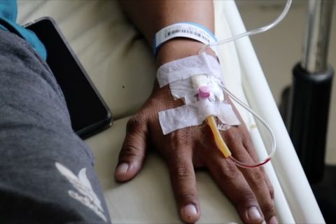 Dirut BPJS Kesehatan: Pasien cacar monyet ditanggung BPJS